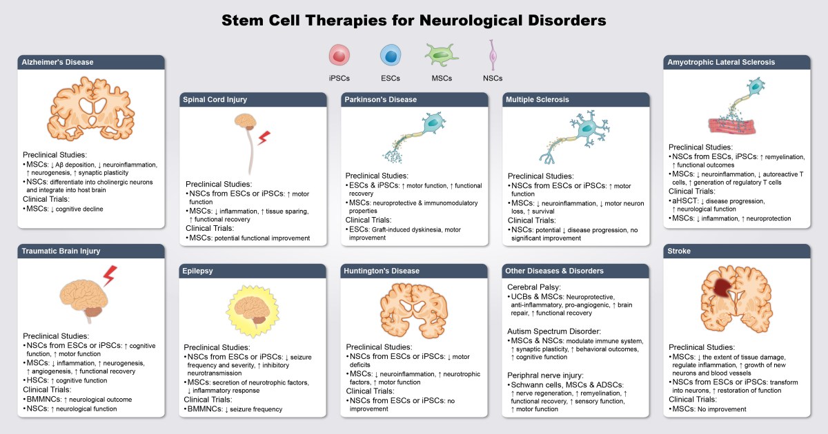 Stem Cell Therapies for Neurological Disorders: A Ten-Disease&nbsp;Overview
