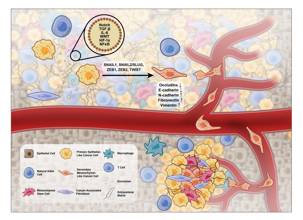 Epithelial–Mesenchymal Transition in the Tumor Microenvironment