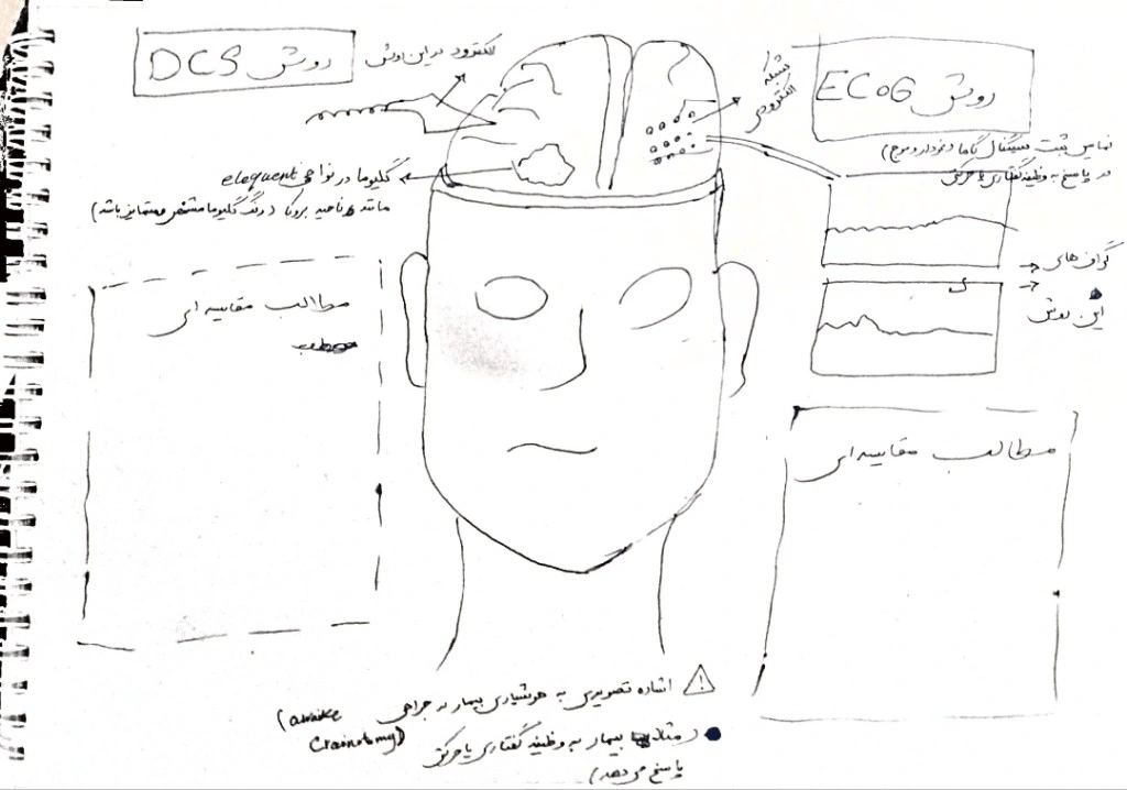 Hand-drawn sketch comparing direct cortical stimulation and electrocorticography, with notes listing the features of each technique