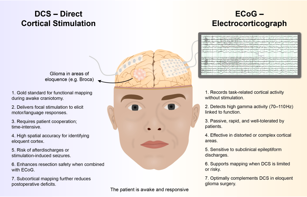 First draft of an illustration comparing direct cortical stimulation (DCS) and electrocorticography (ECoG) during awake brain surgery