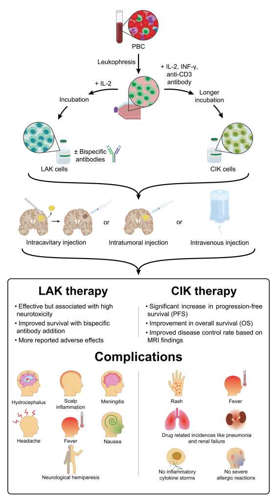Final published illustration of the LAK to CIK continuum in glioma immunotherapy: peripheral blood leukapheresis, LAK cells made with IL-2 and CIK cells made with IL-2, IFN-gamma and anti-CD3, three delivery routes into the brain, and a comparison of therapy outcomes and complications