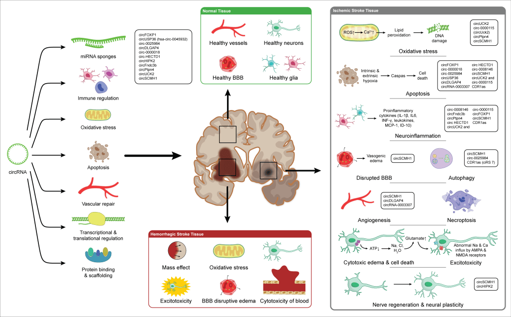 Alternative layout of the circRNA in stroke figure, with arrows instead of zoom lines linking the brain section to the normal, hemorrhagic and ischemic panels
